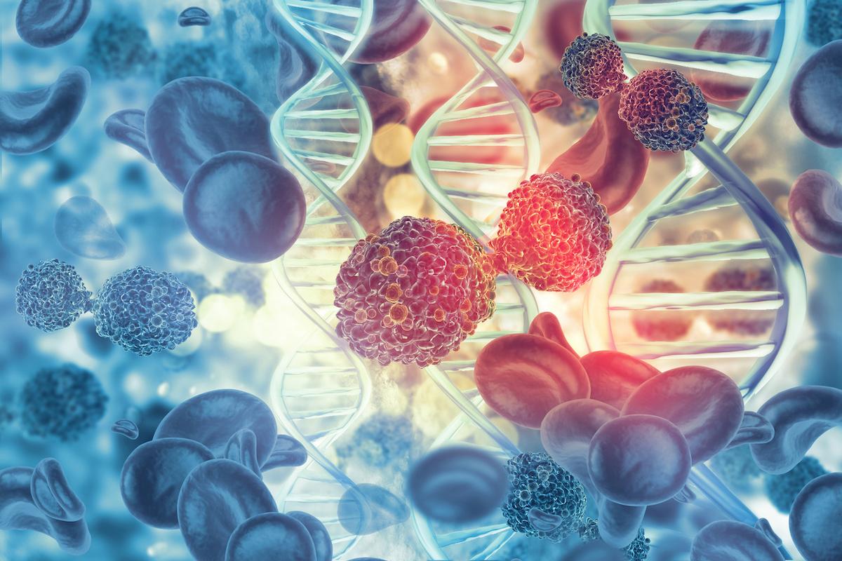 LLC/lymphome lymphocytique : Venetoclax-Obinutuzumab en 1ère ligne