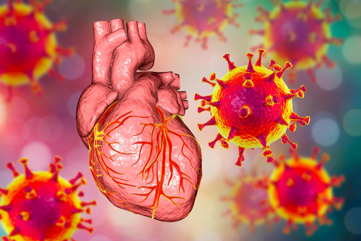 Myocardite et vaccin Covid-19 : meilleure connaissance des mécanismes en jeu