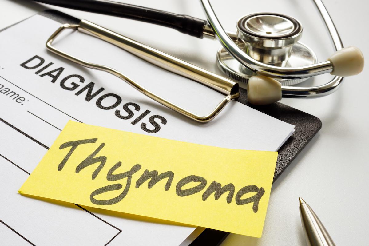 Tumeurs du thymus et du médiastin : nouvelle classification de l’OMS