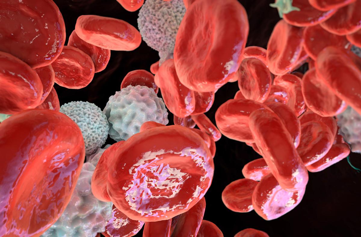 Maladie de Vaquez : association entre la leucocytose et les évènements thrombotiques 