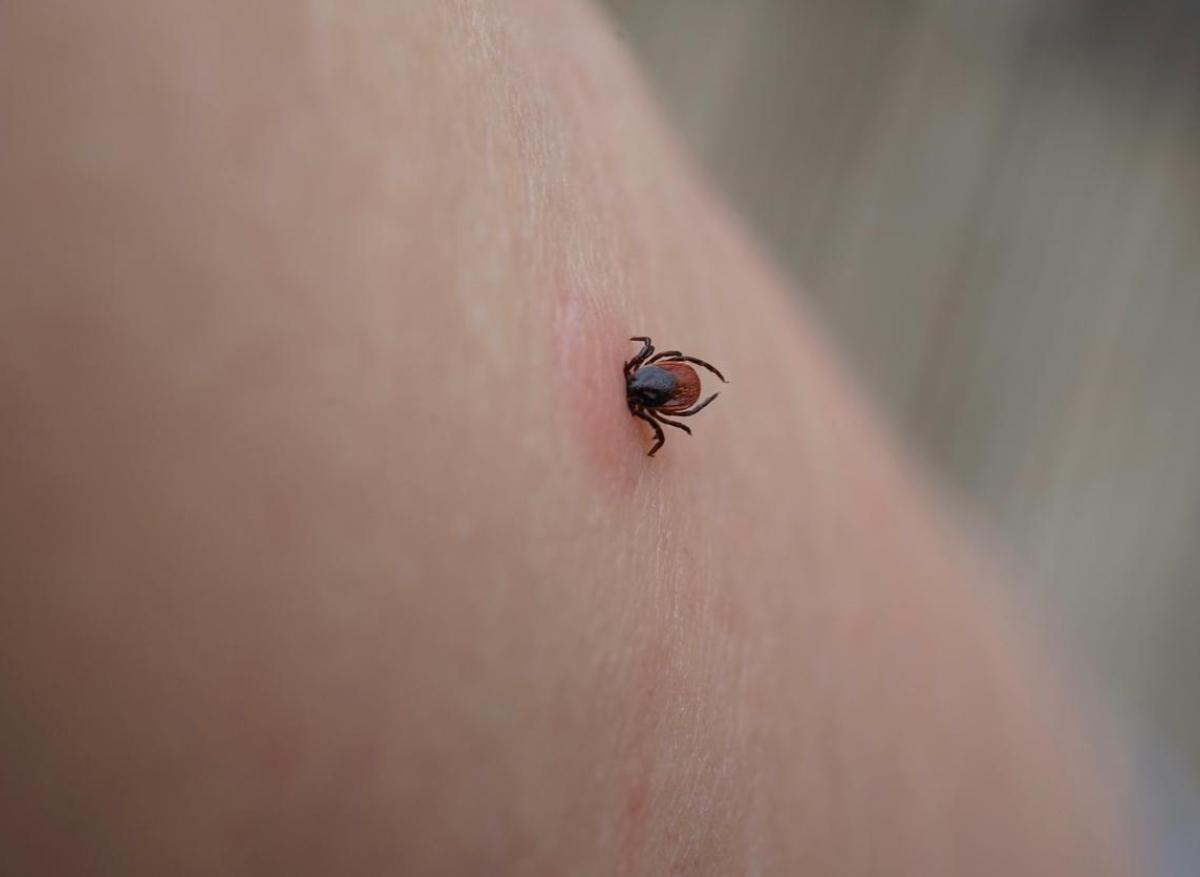 Maladie de Lyme : plus de 14% de la population européenne a des anticorps