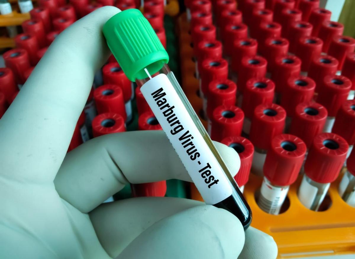 Virus de Marburg : responsable de l'épidémie en Tanzanie