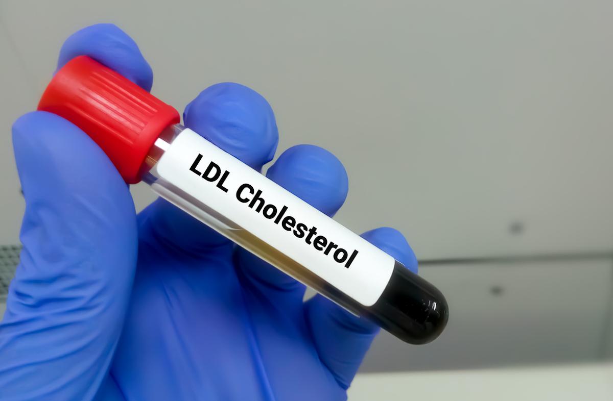 Dyslipidémies sévères : le blocage d’ANGPTL3 par édition de gène abaisse LDL et triglycérides 