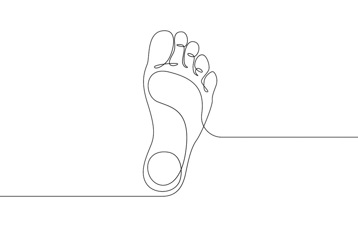 Syndrome du 2ème rayon : une douleur de surcharge localisée de l’avant-pied 