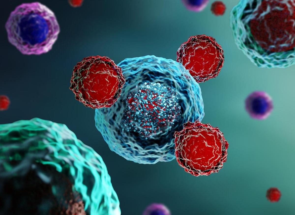 Mélanome : la greffe fécale améliorerait l’effet de l’immunothérapie