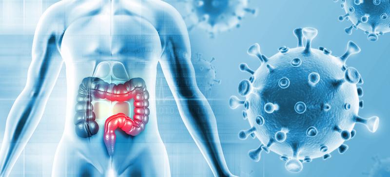 Cancer du côlon localisé : chimiothérapie adjuvante ou périopératoire ?