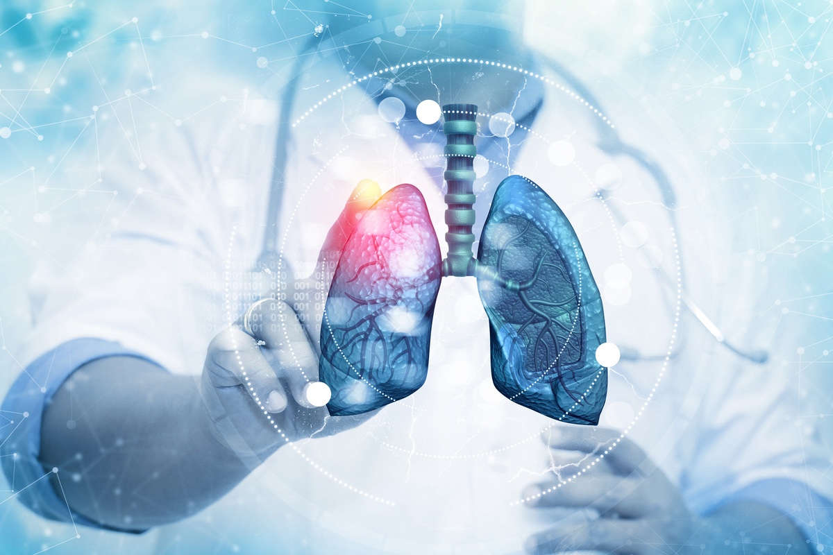 CBNPC : le zidesamtinib pour les patients ROS1 réarrangés, prétraité ou naïfs de TKI  