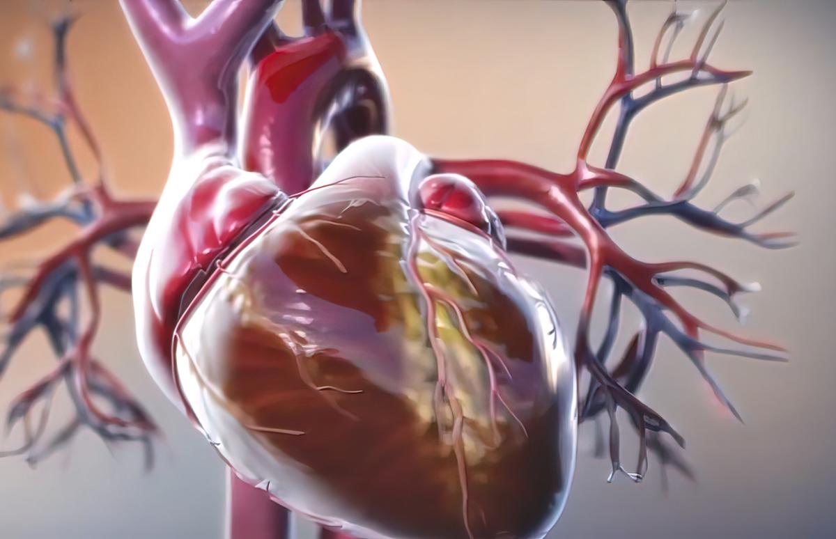 Insuffisance cardiaque à fraction d’éjection préservée : bénéfice d’un agoniste du GLP1 