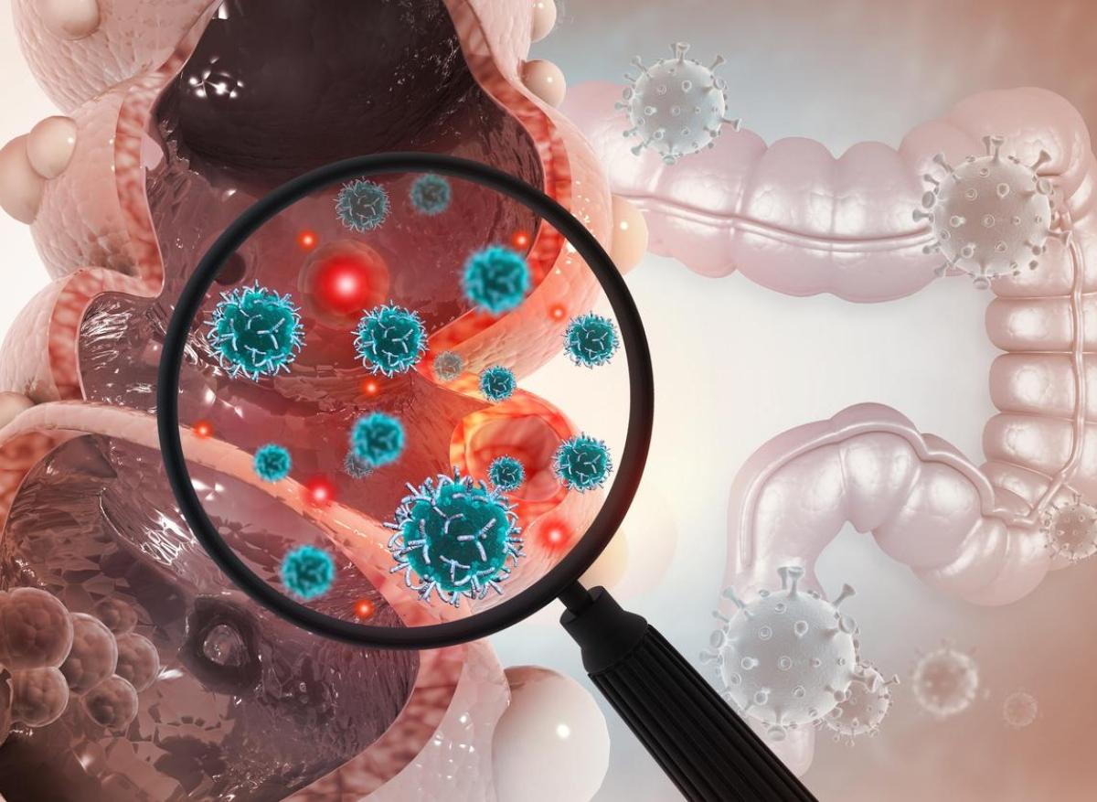 Cancer colorectal : de bactéries du microbiote entraveraient la chimiothérapie