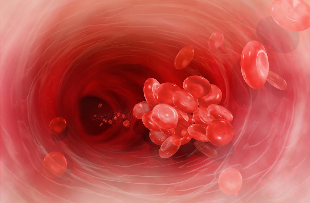 Covid-19 : le traitement anticoagulant sauve réellement des vies