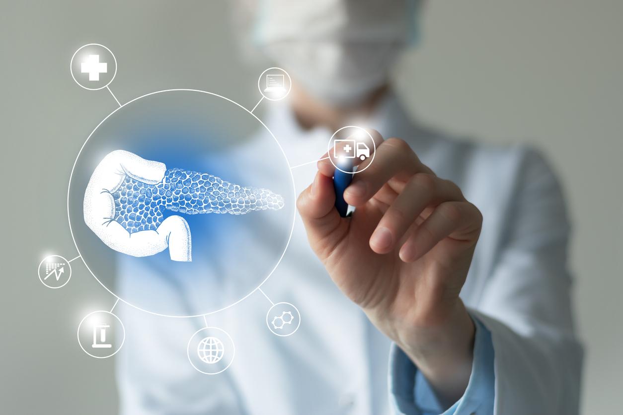Cancer du pancréas : la révolution acte 1 ! 