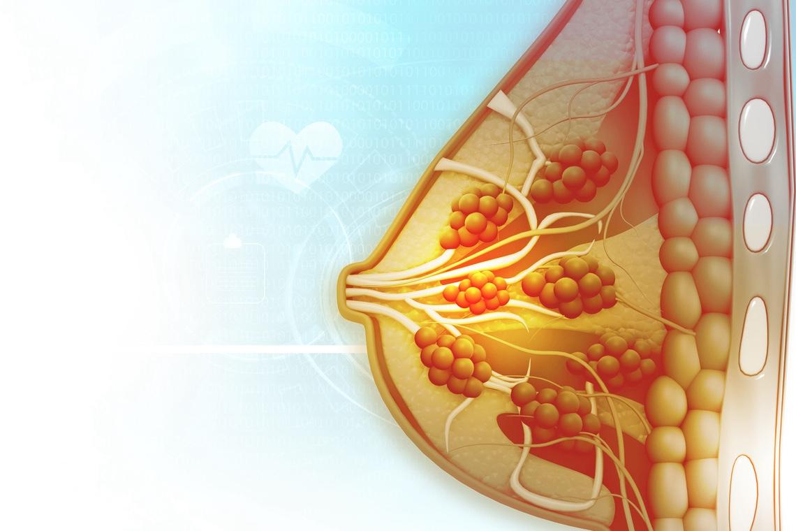 Cancer du sein : quand prescrire les inhibiteurs de CDK4/6 ?