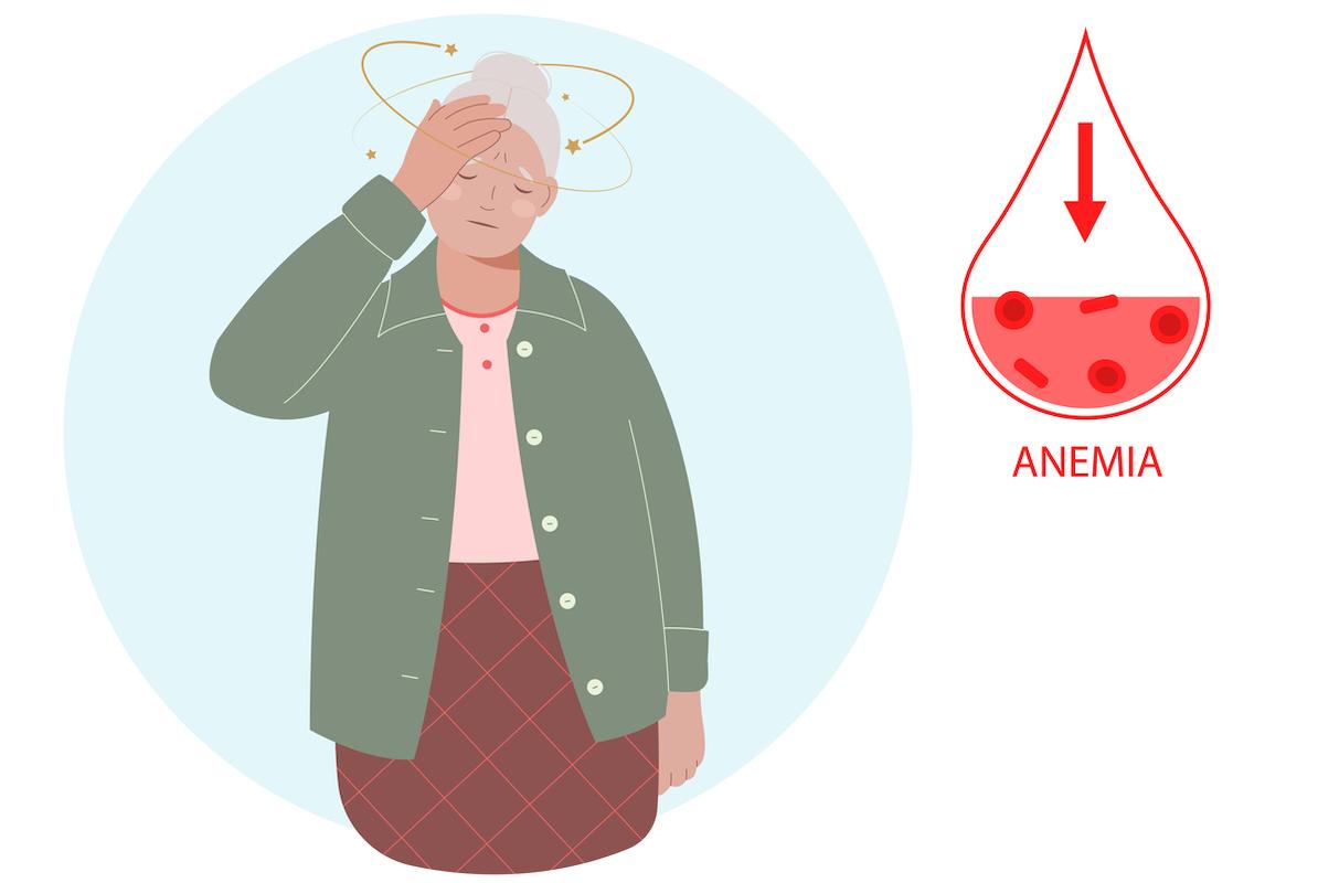 Carence martiale du sujet âgé : la rechercher même en l'absence d'anémie