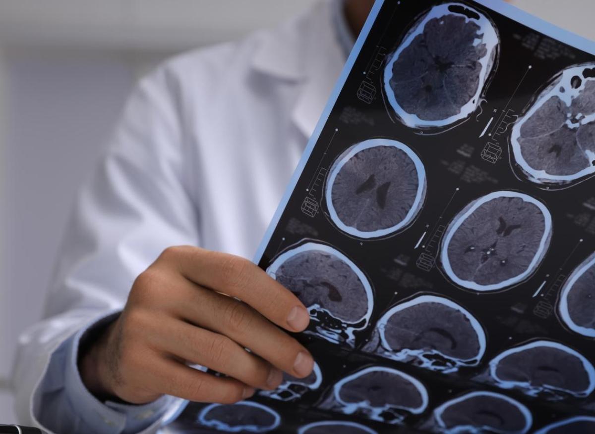 Traumatisme crânien : des implants cérébraux pour rétablir les fonctions cognitives