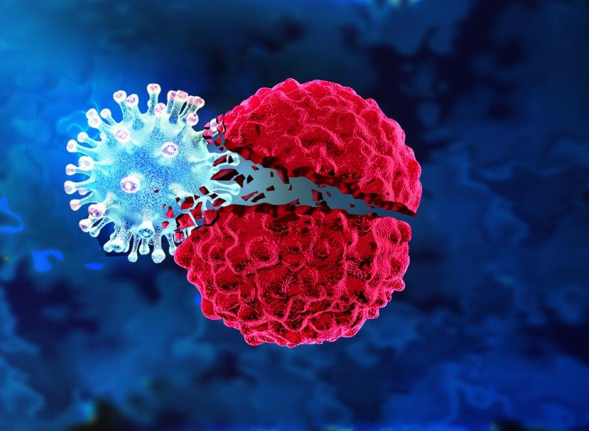 Cancer du sein triple négatif : intérêt d'un traitement par virus oncolytique