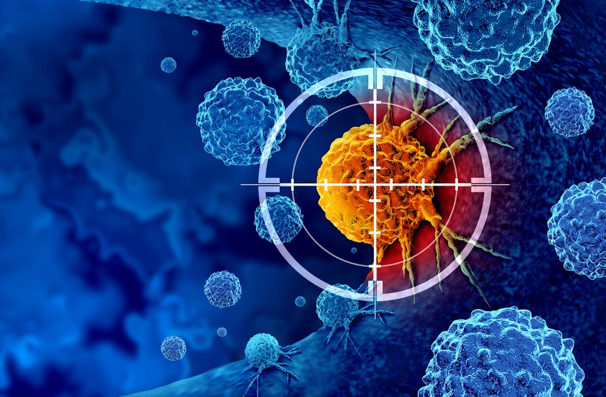 Cancer du poumon métastatique : intérêt d’un anticorps conjugué anti-TROP2