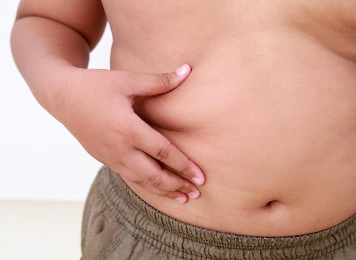 Obésité sévère de l'enfant : réduction de moitié leur espérance de vie