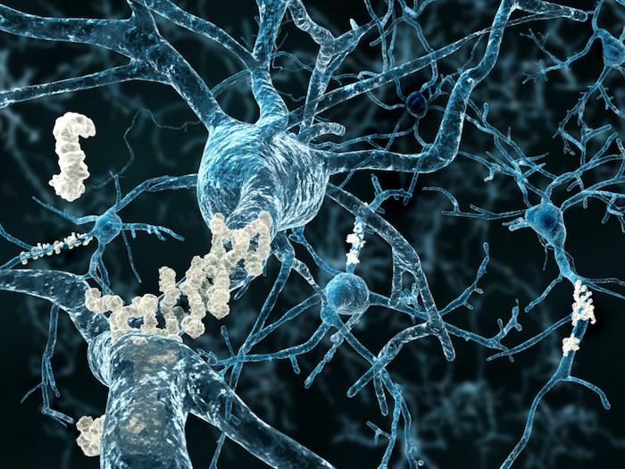 Alzheimer : le cerveau compenserait les lésions à un stade très précoce