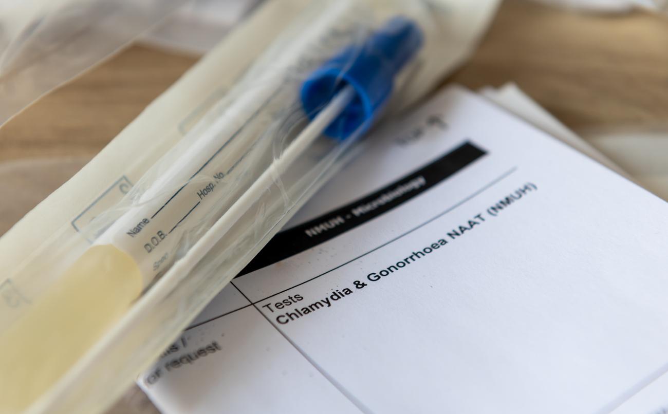 Mon test IST : un kit de dépistage gratuit pour les 18-25 ans