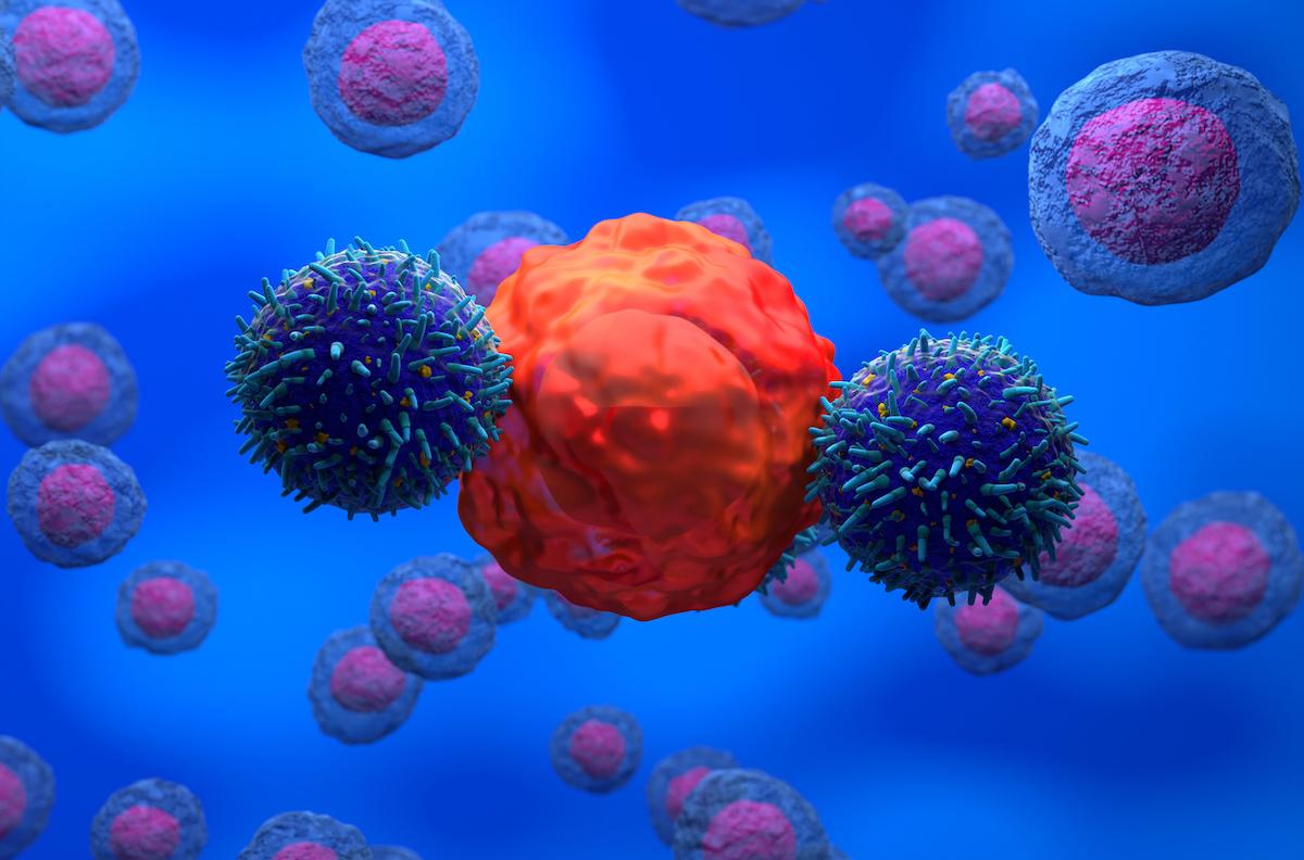 Lymphome B folliculaire et CAR T-cells : données du registre DESCAR-T
