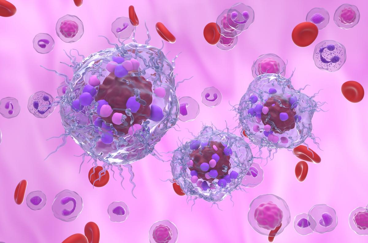 Tumeurs neuroendocrine métastatiques : intérêt démontré d’un inhibiteur de tyrosine kinase