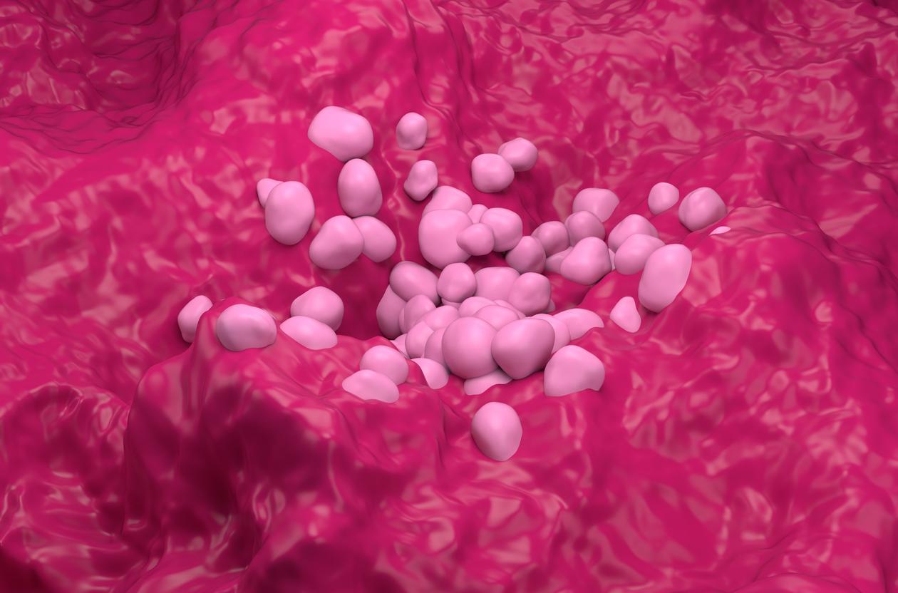 CBNPC précoces porteurs d’une fusion RET : le selpercatinib s’impose en adjuvant 