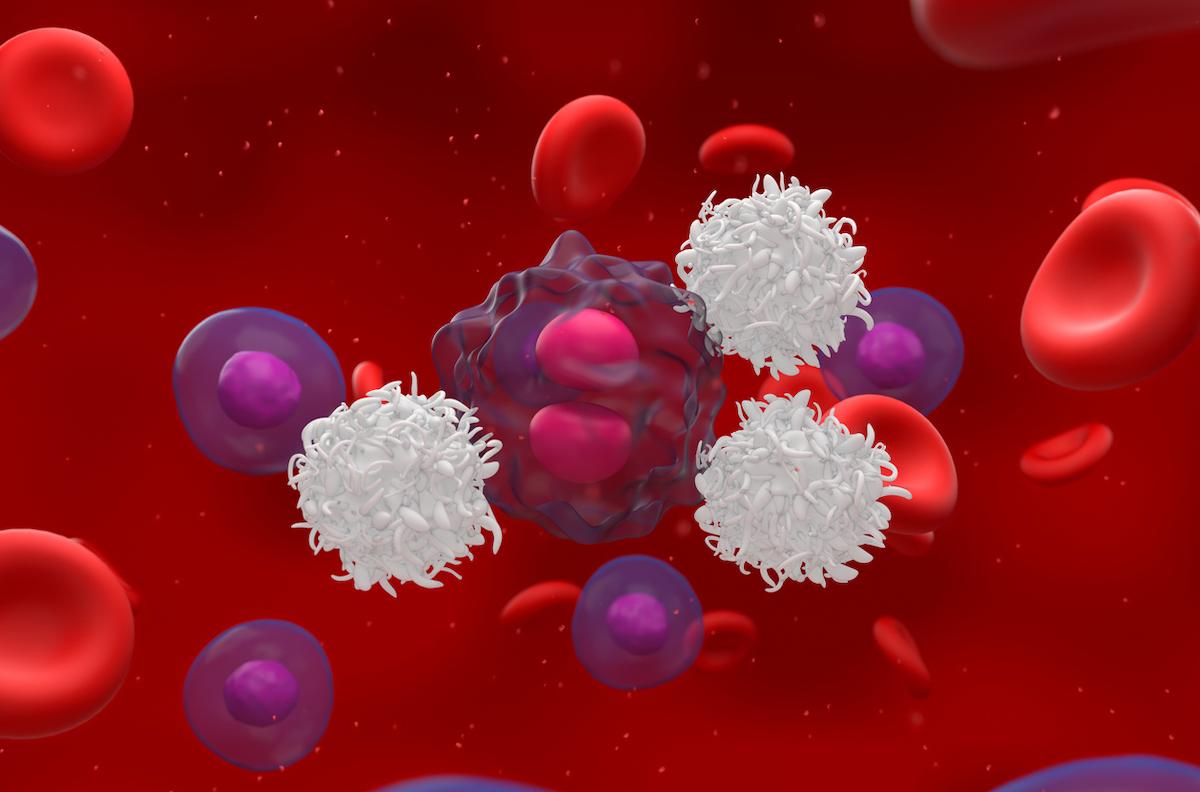 CAR-T cell : risque faible de cancers secondaires 