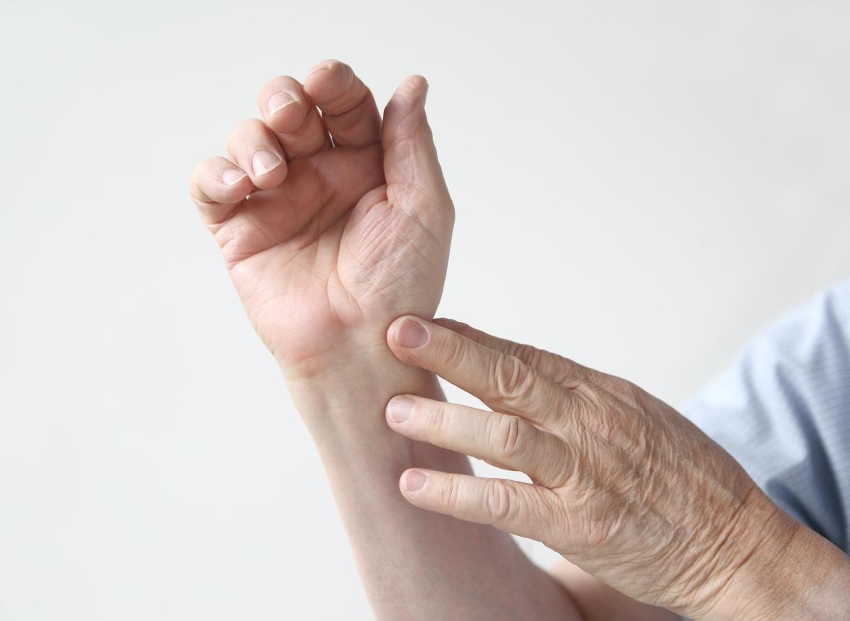 Arthrose de la main avec synovite : le méthotrexate réduit la douleur