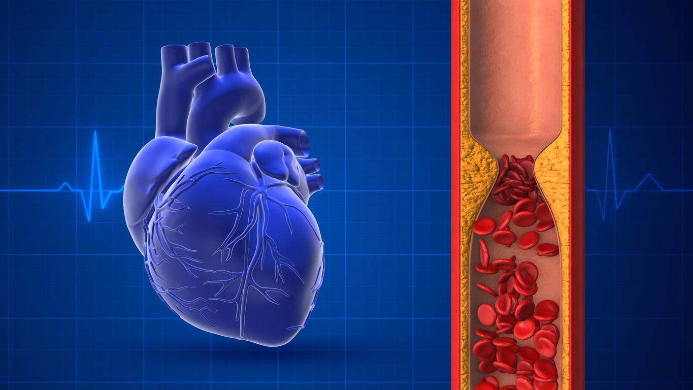 Un cardiologue anglais et Servier au coeur d'un nouveau scandale