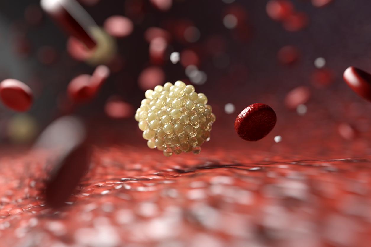 Maladies cardiovasculaires : intérêt confirmé du cholestérol non HDL et l'Apo B pour dépister les patients à risque 