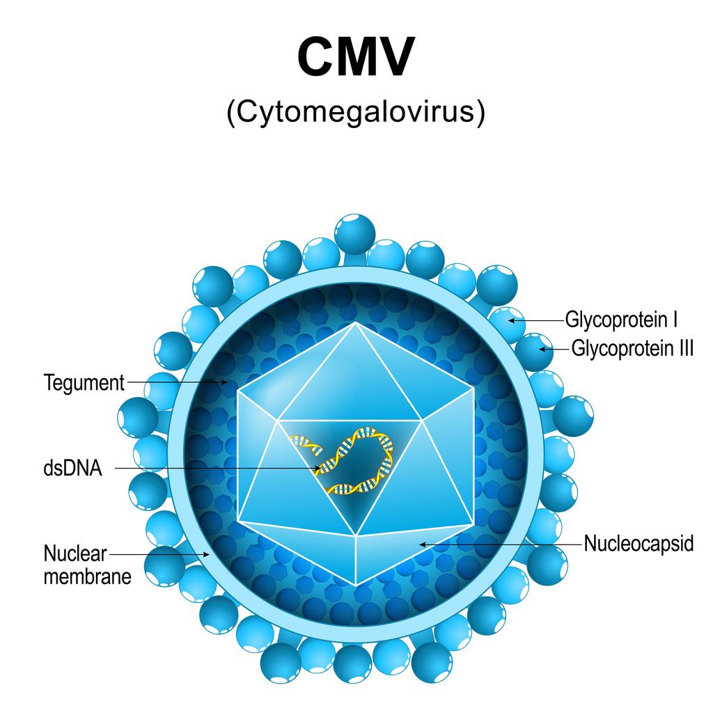 Infection à CMV : un risque accru de déficience intellectuelle et d'autisme