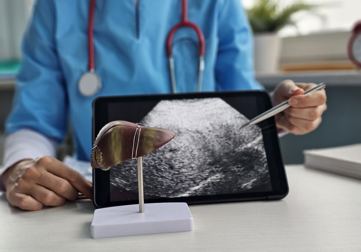 Faut-il abandonner le concept des services d'hépatologie hospitalo-centrés ? 