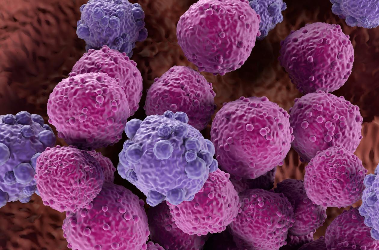 Le lymphome diffus à grandes cellules B : vers un nouveau standard ?