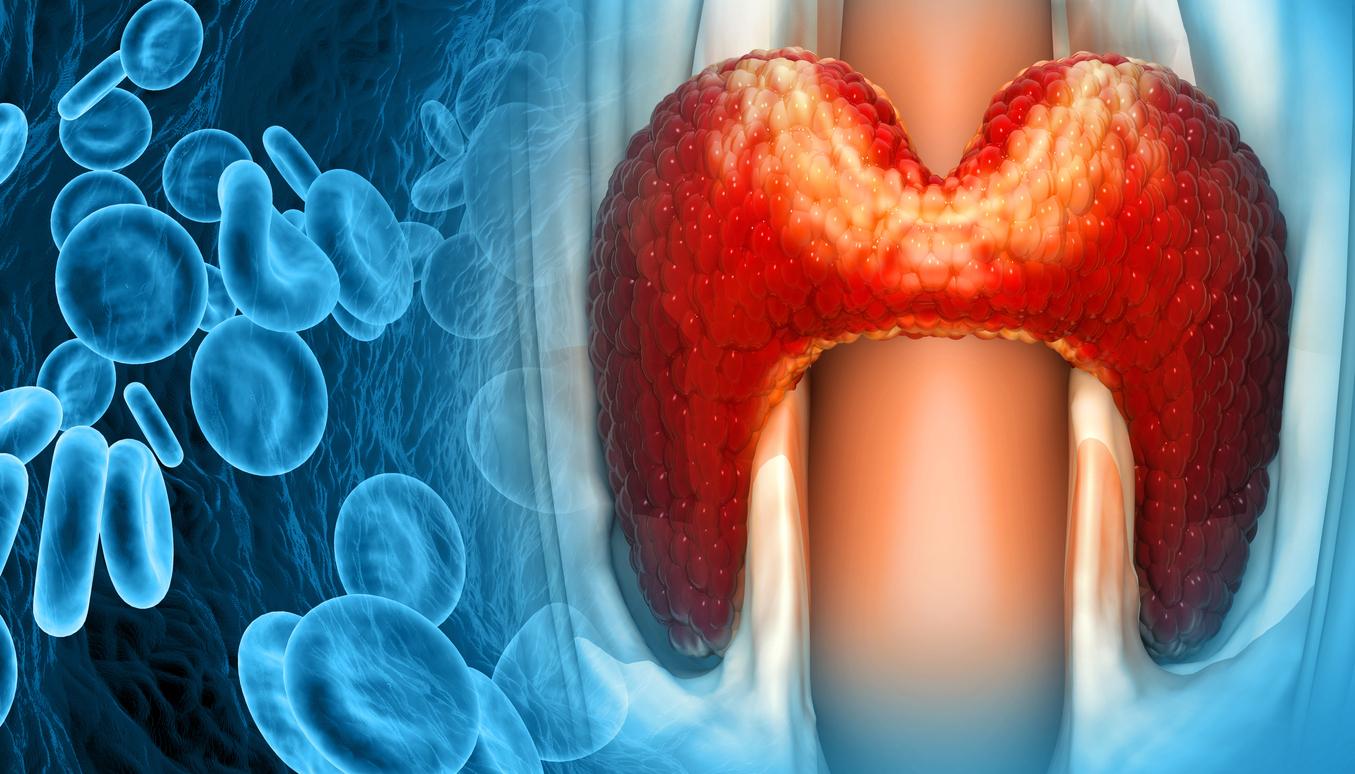  Dysthyroïdies : traiter l'hypothyroïdie réduit le risque cardiovasculaire 