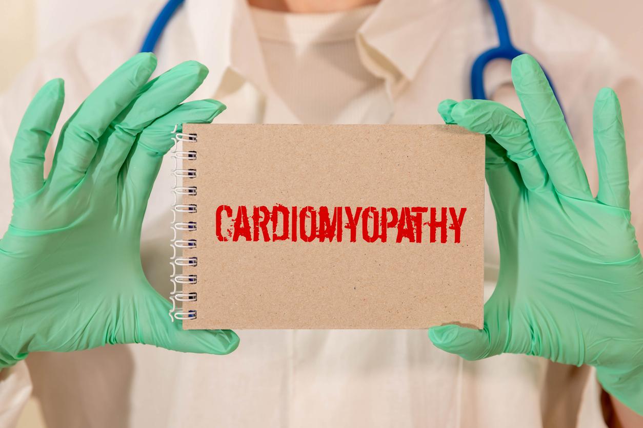 Cardiomyopathie amyloïde à transthyrétine : activité confirmée à 54 mois de l'acoramidis  