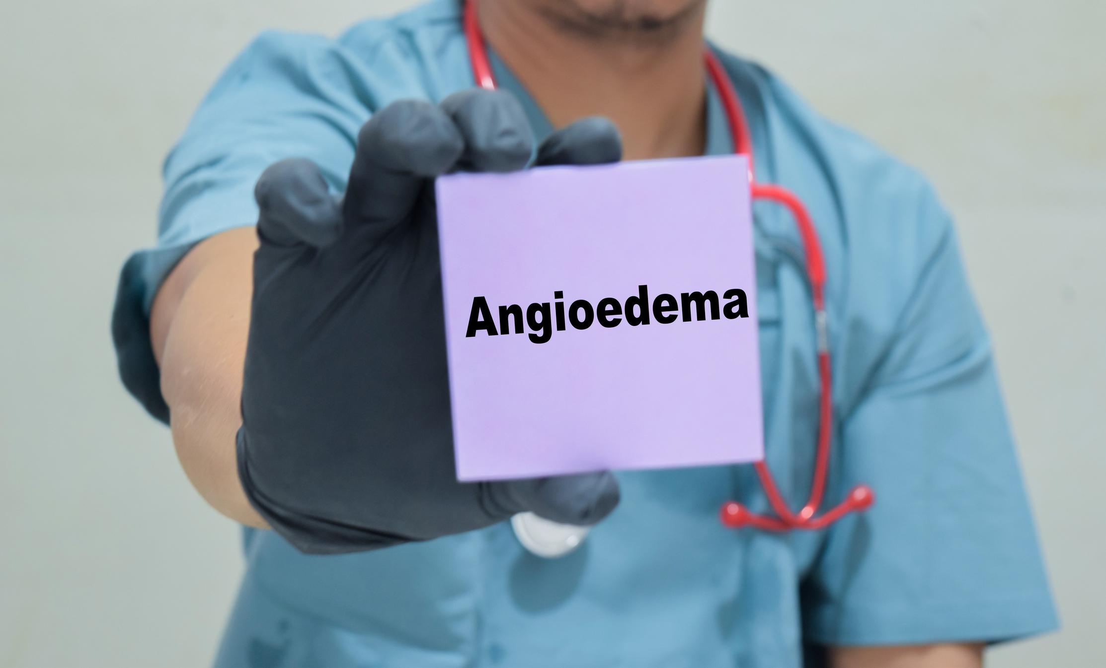 Angio-œdème héréditaire : avec une perfusion unique de lonvo-z, se confirme la voie à un traitement curatif 