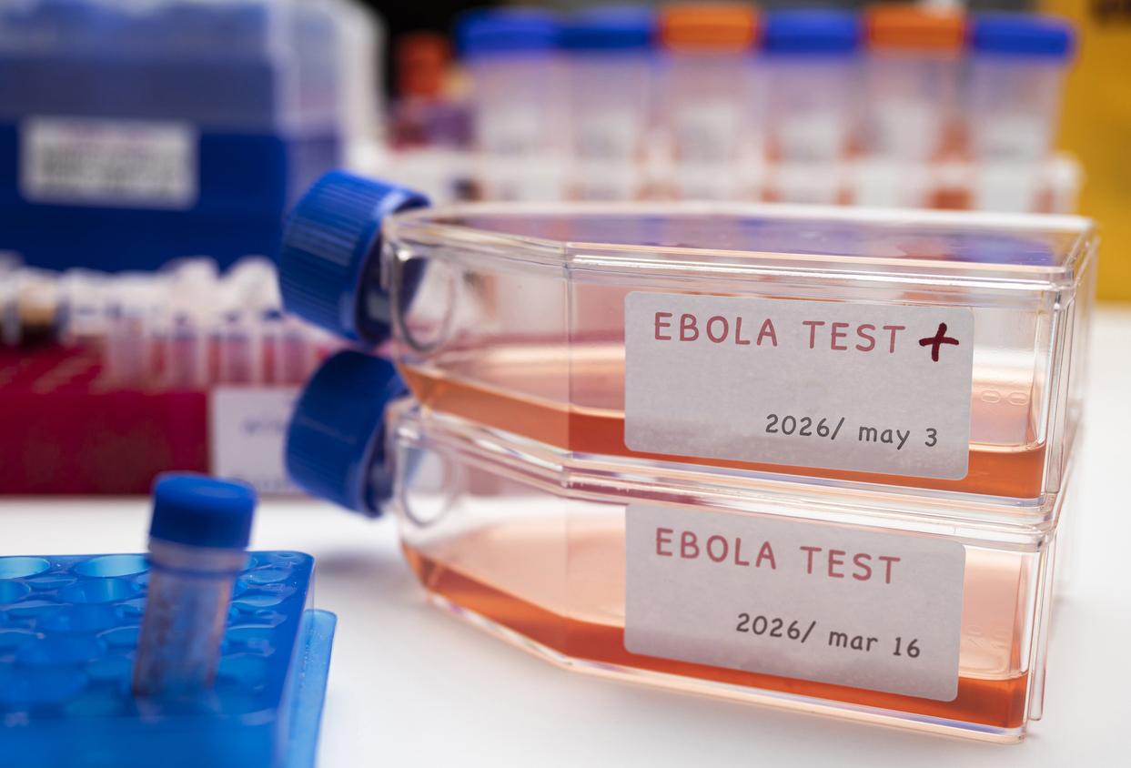 Ebola : une létalité moins importante comparée au virus classique