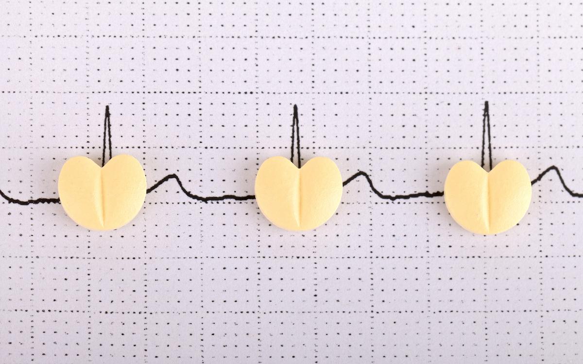 Dépistage de la FA : l’ECG continu 10 fois plus efficace que la clinique