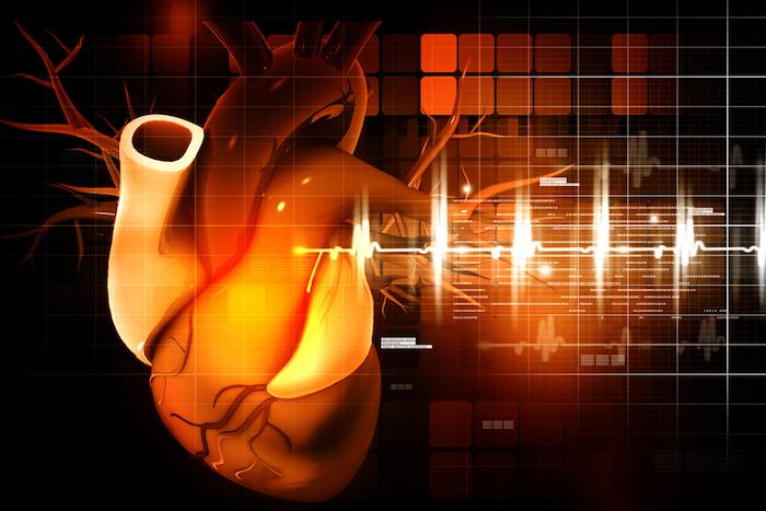 Risque cardiovasculaire : l'inflammation est un facteur de risque chez certains malades