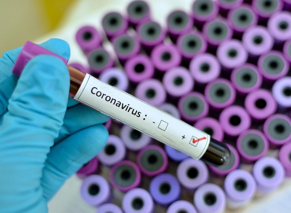 Coronavirus : la maladie pourrait aussi se transmettre par voie fécale