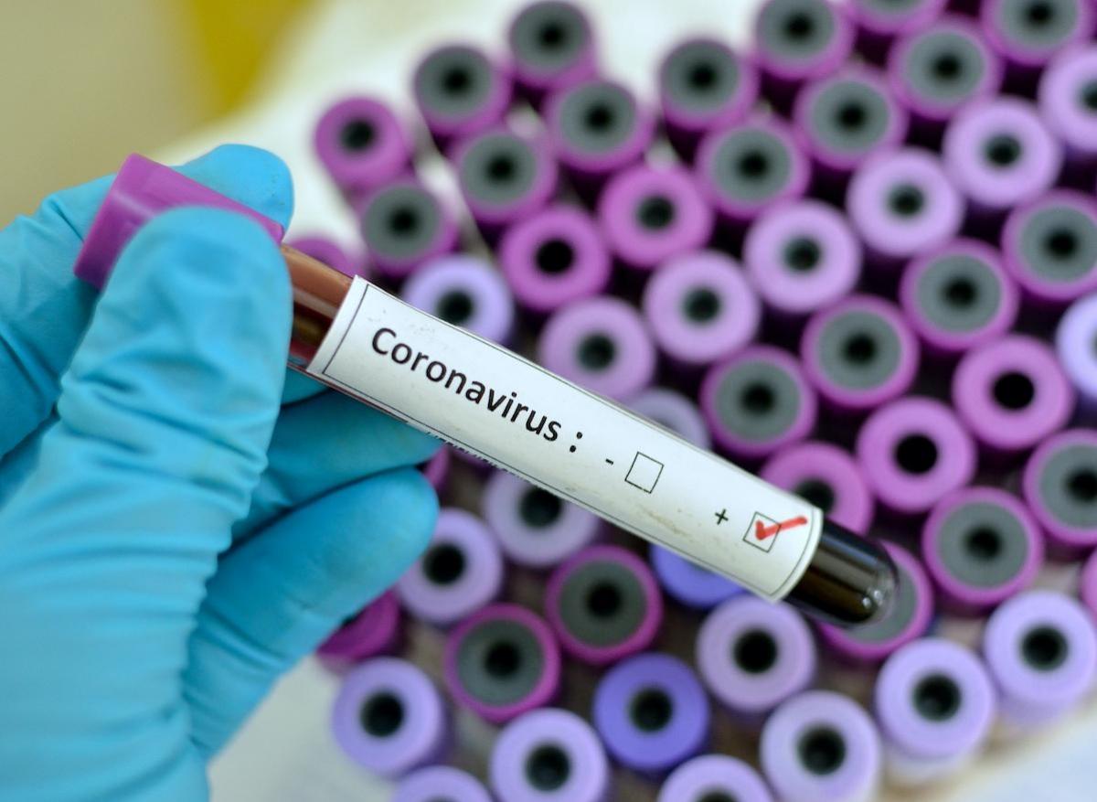 Coronavirus : le vaccin de l’Institut Pasteur est un dérivé de la rougeole