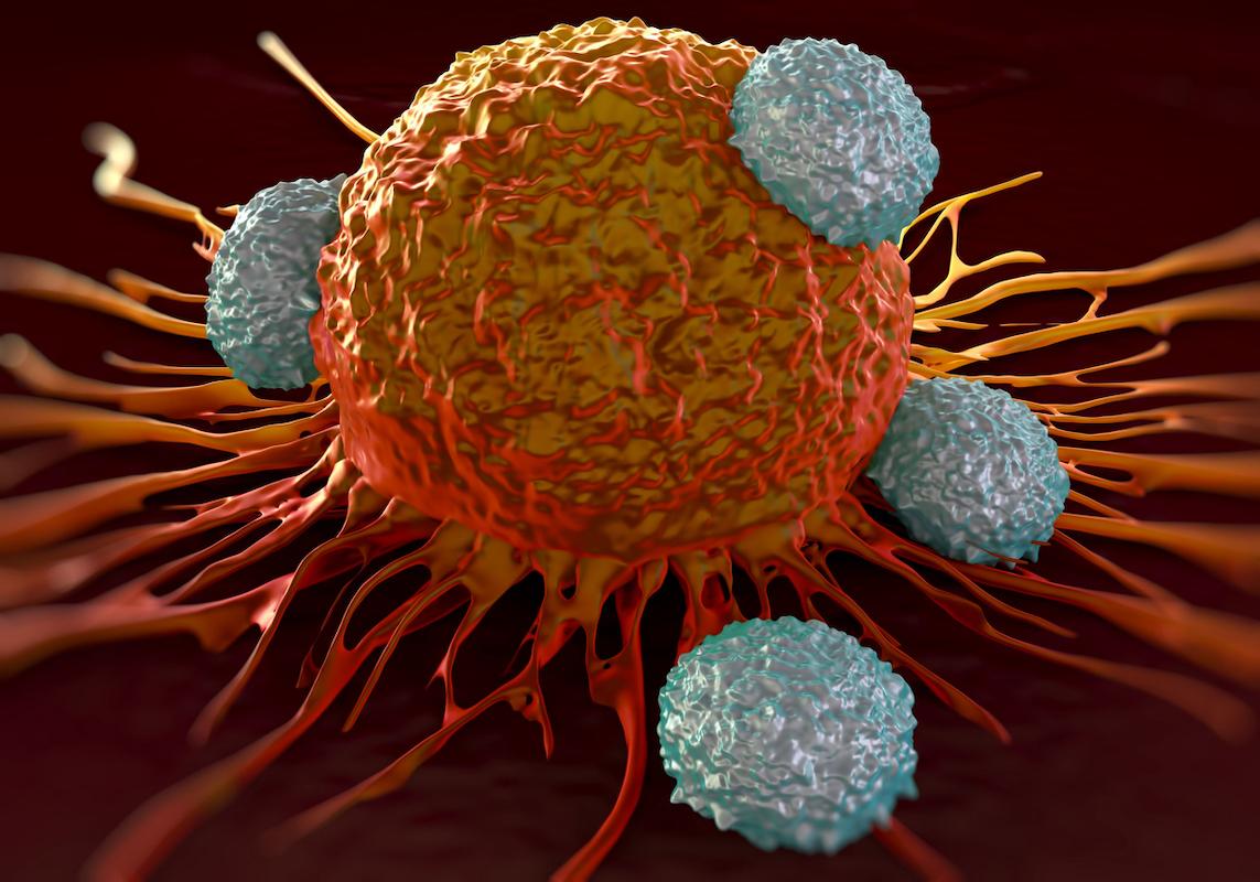 Mélanome réfractaire : intérêt des lymphocytes infiltrant la tumeur (TIL)