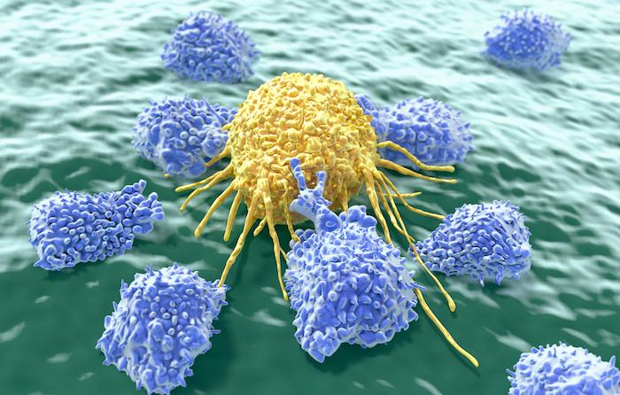 Lymphome B à grandes cellules : efficacité des lymphocytes génétiquement modifiés