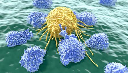 Leucémies, lymphome et myélome : l’immunothérapie cellulaire de 2ème génération arrive