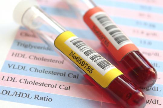 Hypercholestérolémie familiale : baisse du LDL-cholestérol avec un anti-PCSK 9 