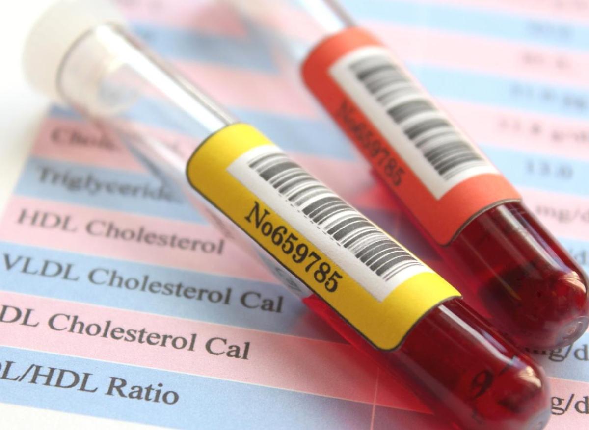 Hypercholestérolémie familiale : dépistage précoce clinique et génétique
