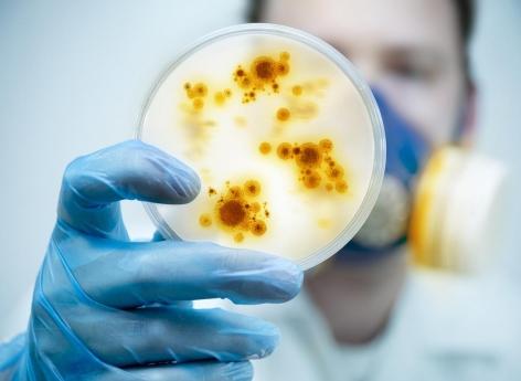 Infections : la promesse d'identidier les bactéries en 30 minutes