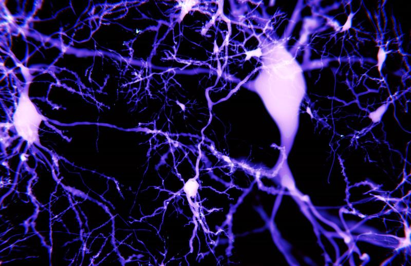 Alzheimer : une nouvelle voie de traitement impliquant les astrocytes
