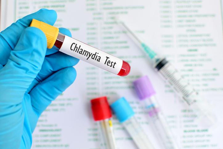Chlamydia : un dépistage systématique recommandé pour les jeunes femmes