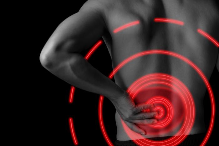 Sciatique chronique : l'inflammation siège à différents niveaux selon les formes